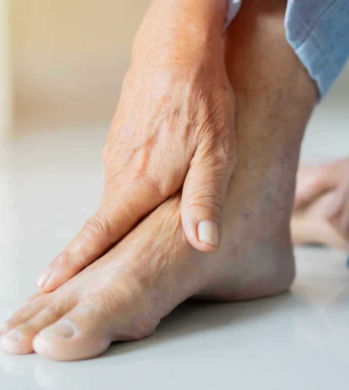 Neuropatía diabética